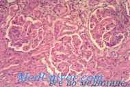 Kronična tubulointersticijski nefritis pri otrocih. Diagnoza in zdravljenje