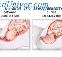 Trebušne mišice med porodom. maternice dejavnost