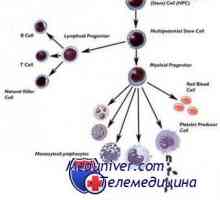 Izvornih celic presajena za kopičenje bolezni in talasemije