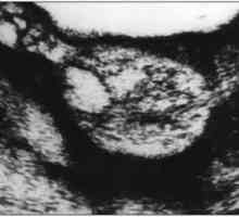 Porodništvo in ginekologiya- echographic diagnozo tumorjev in tumorjev podobnih tvorb jajčnikov…