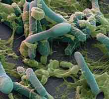 Anaerobne bakterije: vrste