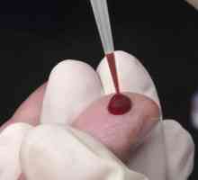 Analiza krvi glist (enterobiasis)