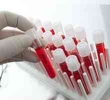Krvni testi za opistorhoz (IFA, biokemija), protitelesa (ATM)