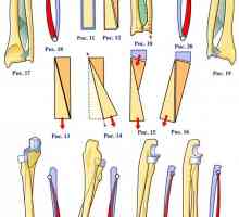 Anatomske strukture sklep in podlahtnico enoto