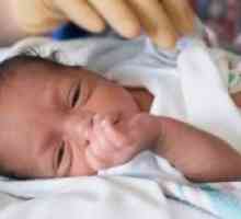 Anemija pri novorojenčkih: vzroki, zdravljenje, obseg, posledice, simptomi, znaki