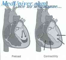Anomalije zarodka ledvic. Oblike fetalne ledvične patologije