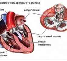 Aortne srčne bolezni: zdravljenje, simptomi, znaki, vzroki