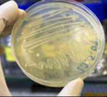 Biokemijska analiza fekalnih bakterij zaraščanja