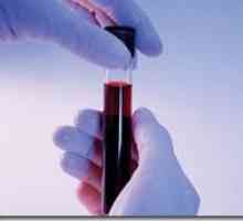 Biokemijska analiza krvi