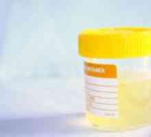 Biokemijska analiza urina