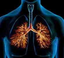 Bronhiektazije v pljučih: zdravljenje, simptomi, diagnostika, vzroki, simptomi