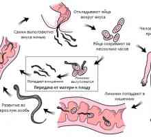 Pogosta okužba (črv napad) glist (enterobiasis) človek