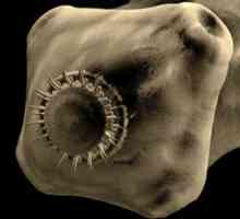 Svinjska trakulja črv parazit, taeniasis bolezni pri ljudeh