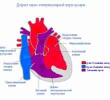 Prekata septalna okvare srca: so vzroki, zdravljenje, simptomi, znaki