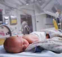 Preponska kila napaka pri novorojenčkih