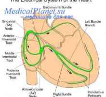 Porazdelitev srčnega krčenja. srčni spodbujevalnik