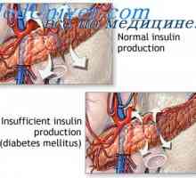 Učinek insulina na presnovo ogljikovih hidratov. Izmenjava glukoze inzulin