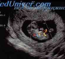 Dopplerjev ultrazvočni zarodka. Pretok Študija kri v fetalnih duktusa venosus