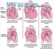 Minutni volumen srca po srčnem napadu. Kompenzirati srčno popuščanje