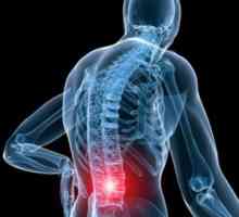 Fiziološke bolečine v hrbtu