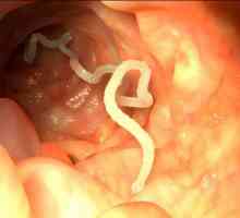 Kje je črv-trakulja v človeškem telesu?