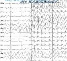 Kaj povzroča in se ustavi veliko epileptični napad? Malaya epilepsija