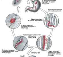 Gliste (črvi), ki živijo v mišicah, simptomi človeških in fotografij