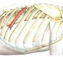Kirurški pristopi k prsni hrbtenici