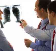Kronična intersticijska pljučnica in pljučna fibroza, zdravljenje, simptomi, vzroki