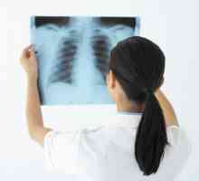 Kronična pljučna absces