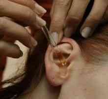 Kronično gnojno vnetje srednjega ušesa: zdravljenje, simptomi, znaki, vzroki