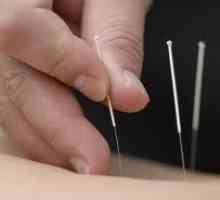 Akupunktura za pankreatitis