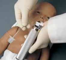 Neonatalno intubacijo: Tehnologija cevi intubacijo