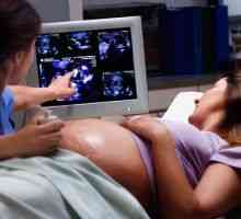 Umetna biološka ventili v nosečnosti