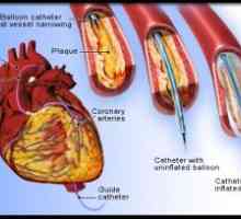 Študija arterij