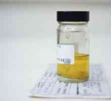 Analiza urina, analiza urina