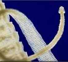 Izgon črvov iz človeškega telesa, kot tudi hitrejši izgon črevesnimi glistami?