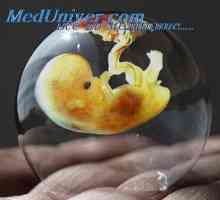 Spremembe v maternici med implantacijo. Struktura placente