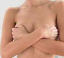 Ekcem na bradavico dojke: Zdravljenje, simptomi, vzroki