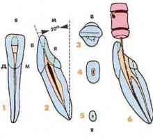 Endodontsko vidiki morfologije spodnjih stalnih zob
