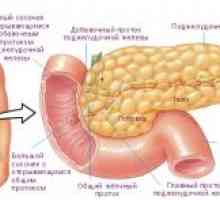 Endokrini tumor pankreasa