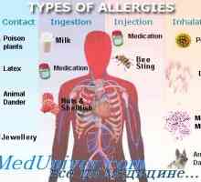 Epidemiologijo (razširjenost) alergijskih bolezni atopije