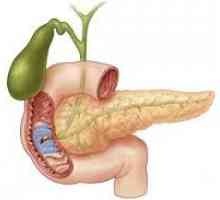 Erozivni in ulcerozni duodenitis