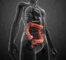 Kako za zdravljenje vnetja sigmoidno debelega črevesa?