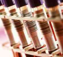 Kaj krvni testi prenese v bolezni trebušne slinavke?