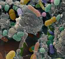 Katere teste opraviti na dysbacteriosis?