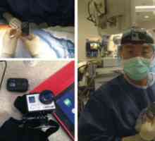 GoPro kamero za usposabljanje kirurgov