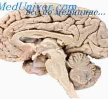Nevrohumoralnimi ureditev delovanja možganov. Nevrohormonska sistemi človeške možgane