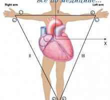 Vectorcardiogram. Električna os srca