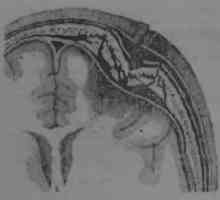 Klasifikacija poškodb strelnih lobanje in možganov